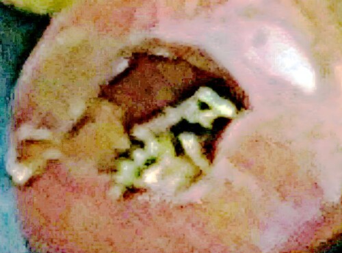 K800_Gemeine-WespeVespula-vulgarisL.-1758_upscayl_1x_upscayl-standard-4x.jpeg