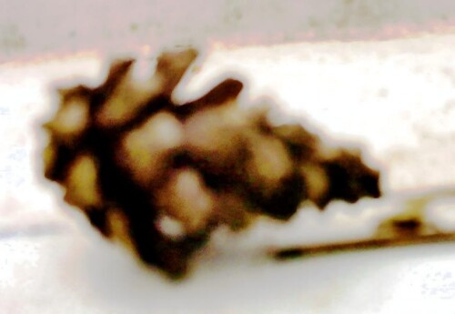 K800_Zapfen-einer-WaldkieferPinus-sylvestrisL.-1758_upscayl_1x_upscayl-standard-4x.jpeg